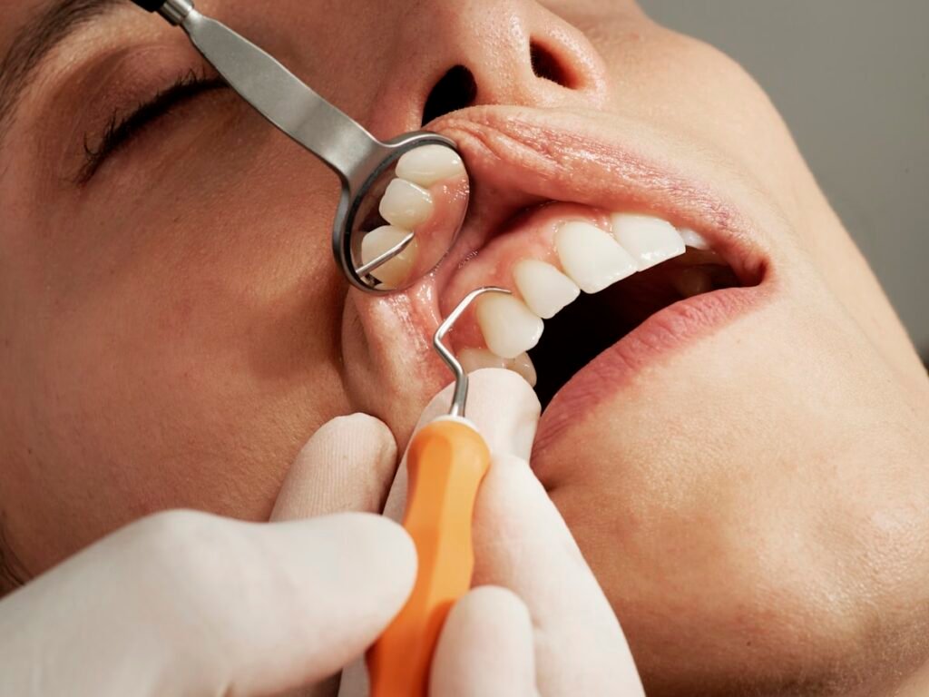Facetas de porcelana vs lente de contato dental - diferenças e indicações | Fanti Clinic