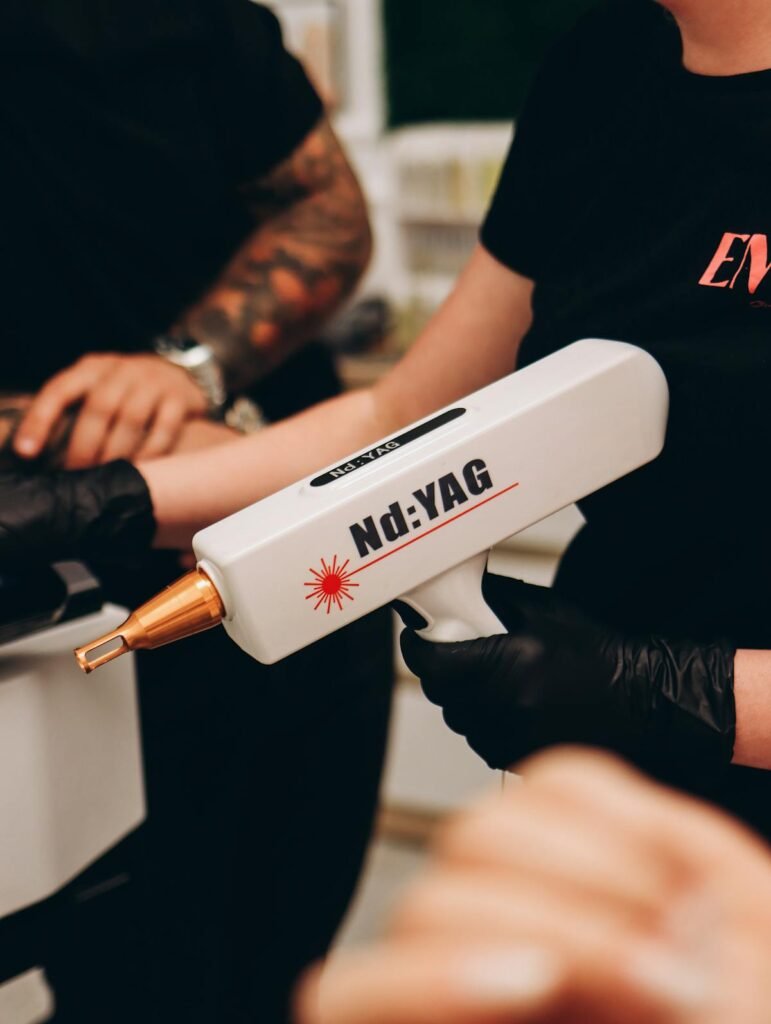 Laser de remoção de tatuagem em procedimento clínico - quanto custa remoção de tatuagem | Fanti Clinic